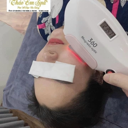 Triệt mặt bảo hành trọn đời 