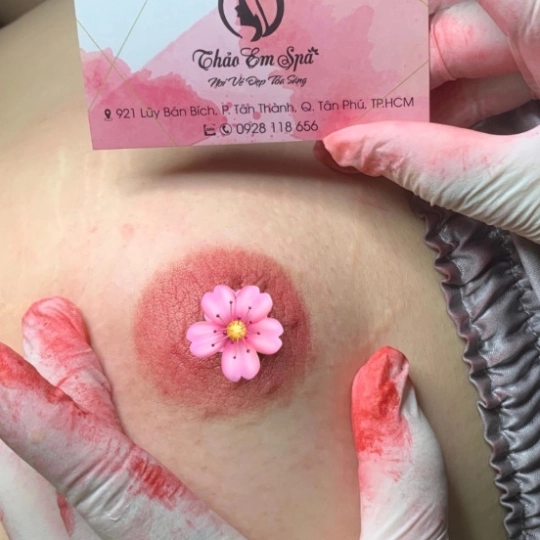 Phun hồng nhũ hoa