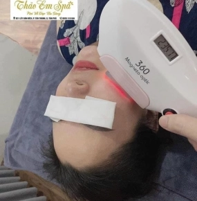 Triệt mặt bảo hành trọn đời 