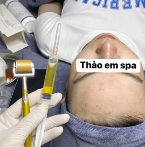 Lăn kim điều trị