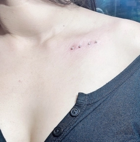 Xỏ xương quai xanh