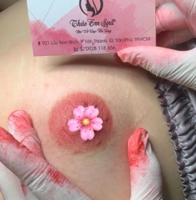 Phun hồng nhũ hoa